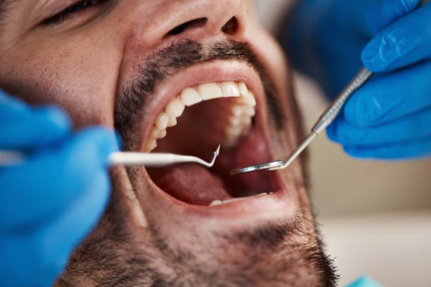 Best Broken Tooth Emergency  in Warner Robins, GA